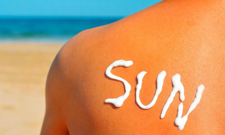 An effective way to treat sunburn include its prevention