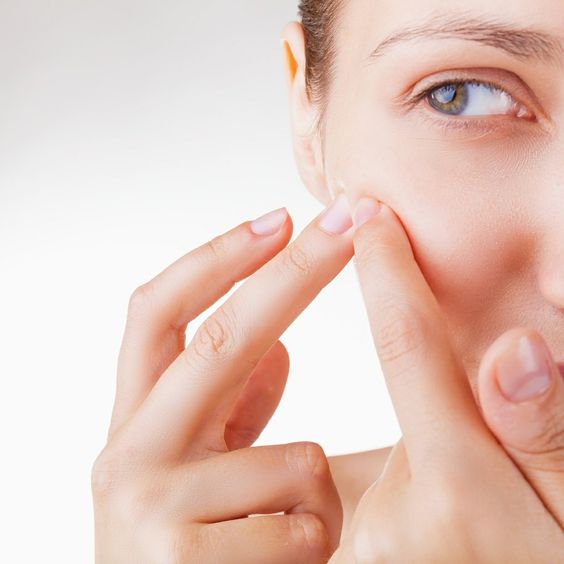 Popping pimple with hand without expert concern could worsen the swelling