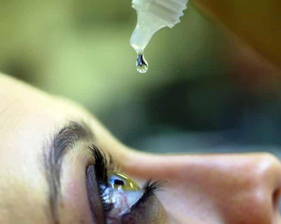 treat blepharitis by using eye drop